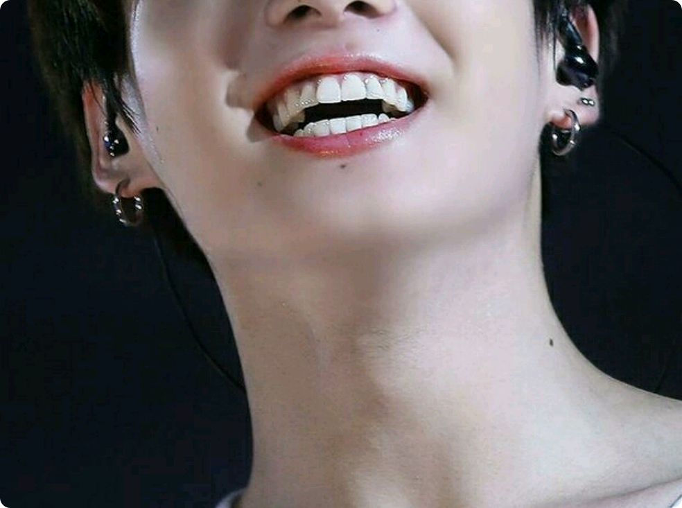 키스셔틀 thumbnail