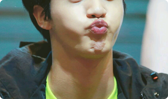 프롤로그 thumbnail