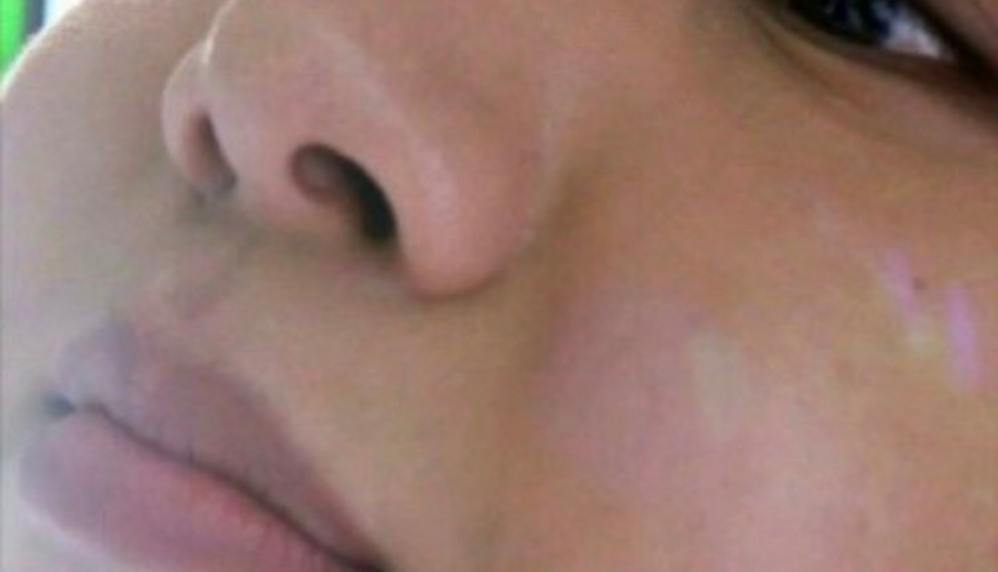 hobi的脸颊 thumbnail