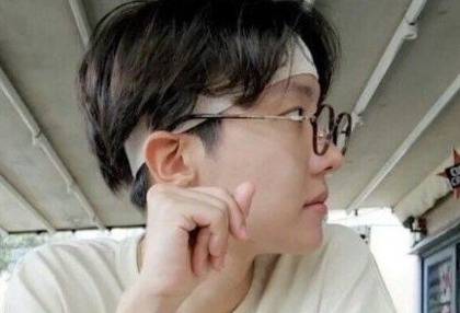 Mất thumbnail