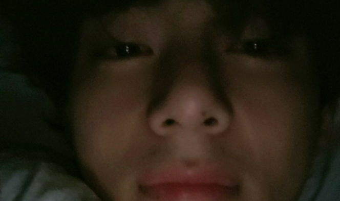 TAE에 대한 투표 thumbnail