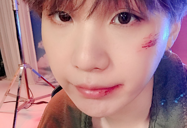 윤기 💗 thumbnail