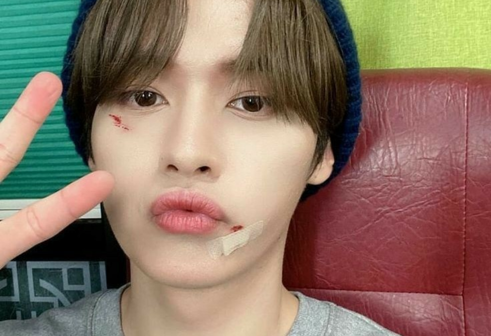 리노에게 투표하세요. thumbnail