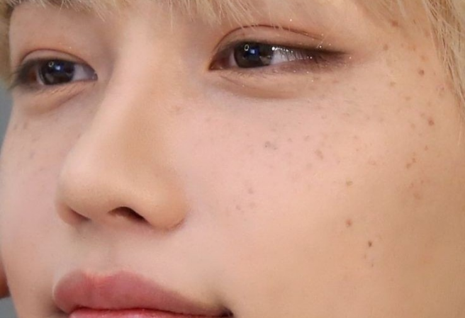 펠릭스에게 투표해주세요♡ thumbnail