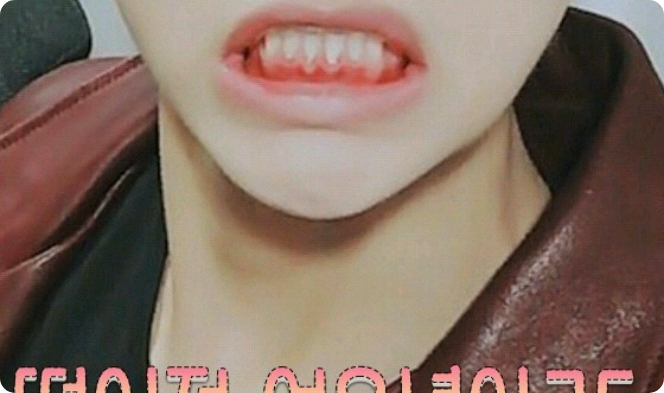 떨어져 여우년아 ㅋㅌ thumbnail